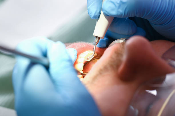 Best Same-Day Emergency Dentist in Governors Clu, NC