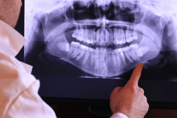Best Emergency Dental Care for Trauma or Injury in Governors Clu, NC
