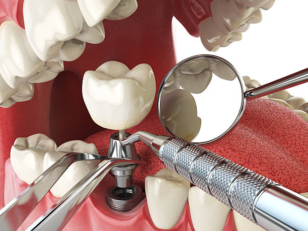 Best Walk-In Emergency Dentist in Governors Clu, NC